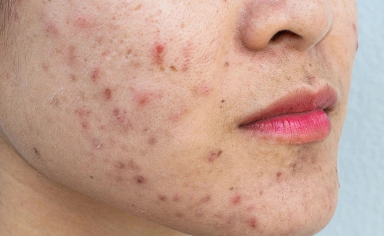 Top 7 Skin Problems That Need a Dermatologist (Not Just Home Remedies)