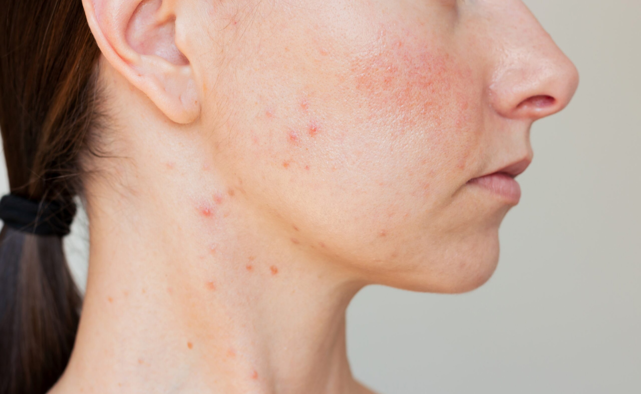 Top 7 Skin Problems That Need a Dermatologist (Not Just Home Remedies)