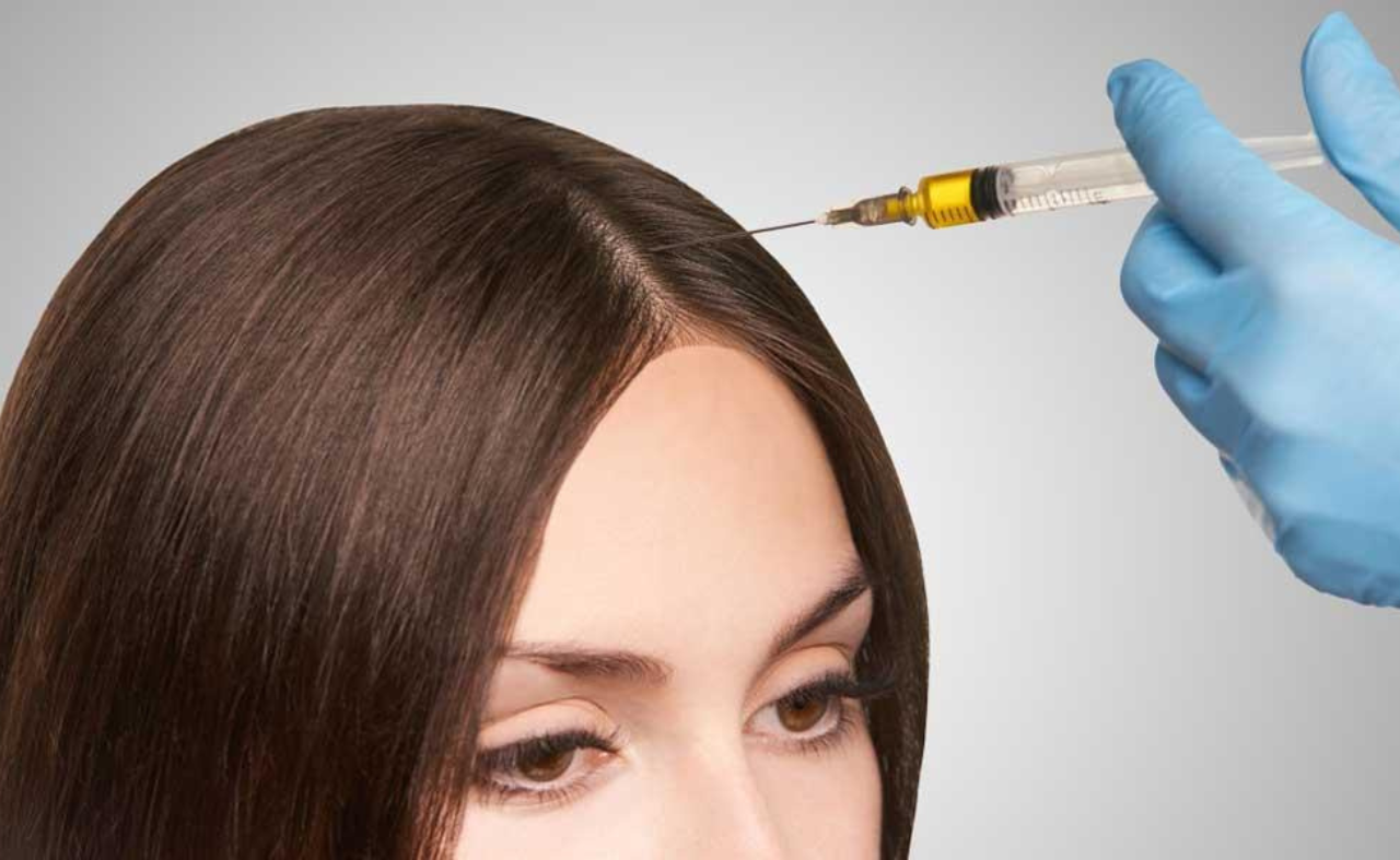 PRP Hair Treatment Explained: Does It Really Work for Hair Fall?