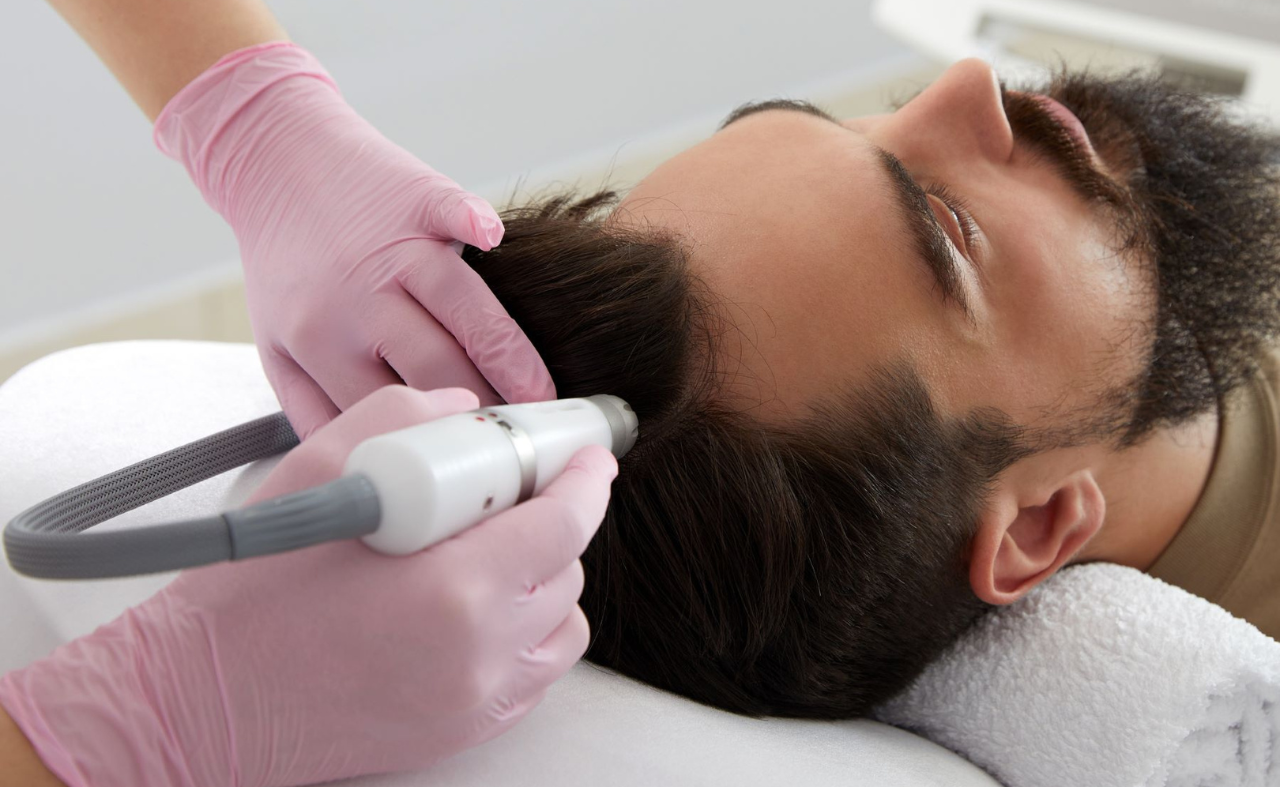 Best Non-Surgical Hair Restoration Options You Should Know About