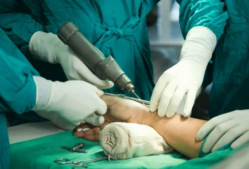 Microvascular Surgeries