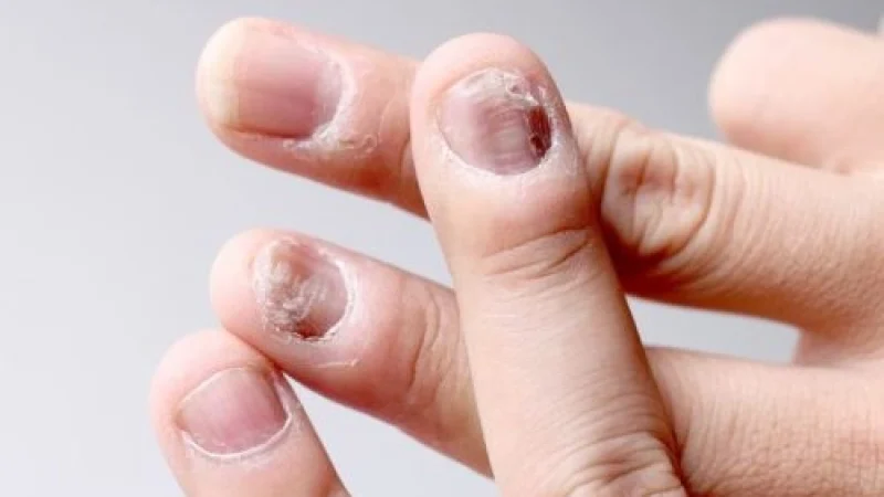 Nail-Diseases-1024x597-1-r41mbhcnr7jjfrgmr44i81l99dh9rmwwq3nwokca4o