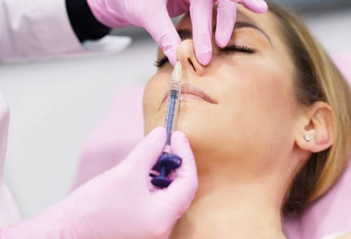 Rhinoplasty Rhinoplasty