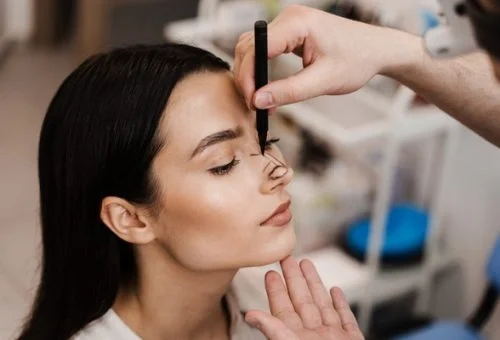 Rhinoplasty