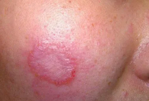 fi_03-r41ljlh105db07ytl26y92wytux9ew7kw2xc51oqq0