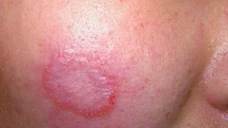 fi_03-r41ljlh105db07ytl26y92wytux9ew7kw2xc51oqq0