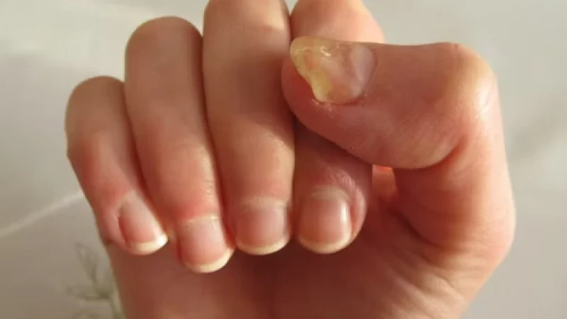 file-20170420-2395-ce7gst-r41mdzl5zaz2ebtk474ovetiad4iakv52iaiiuxog0